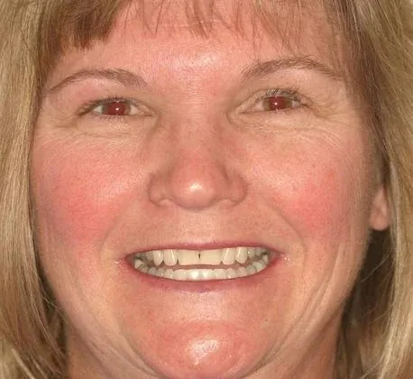 Margie's smile before treatment at The Smile Center.