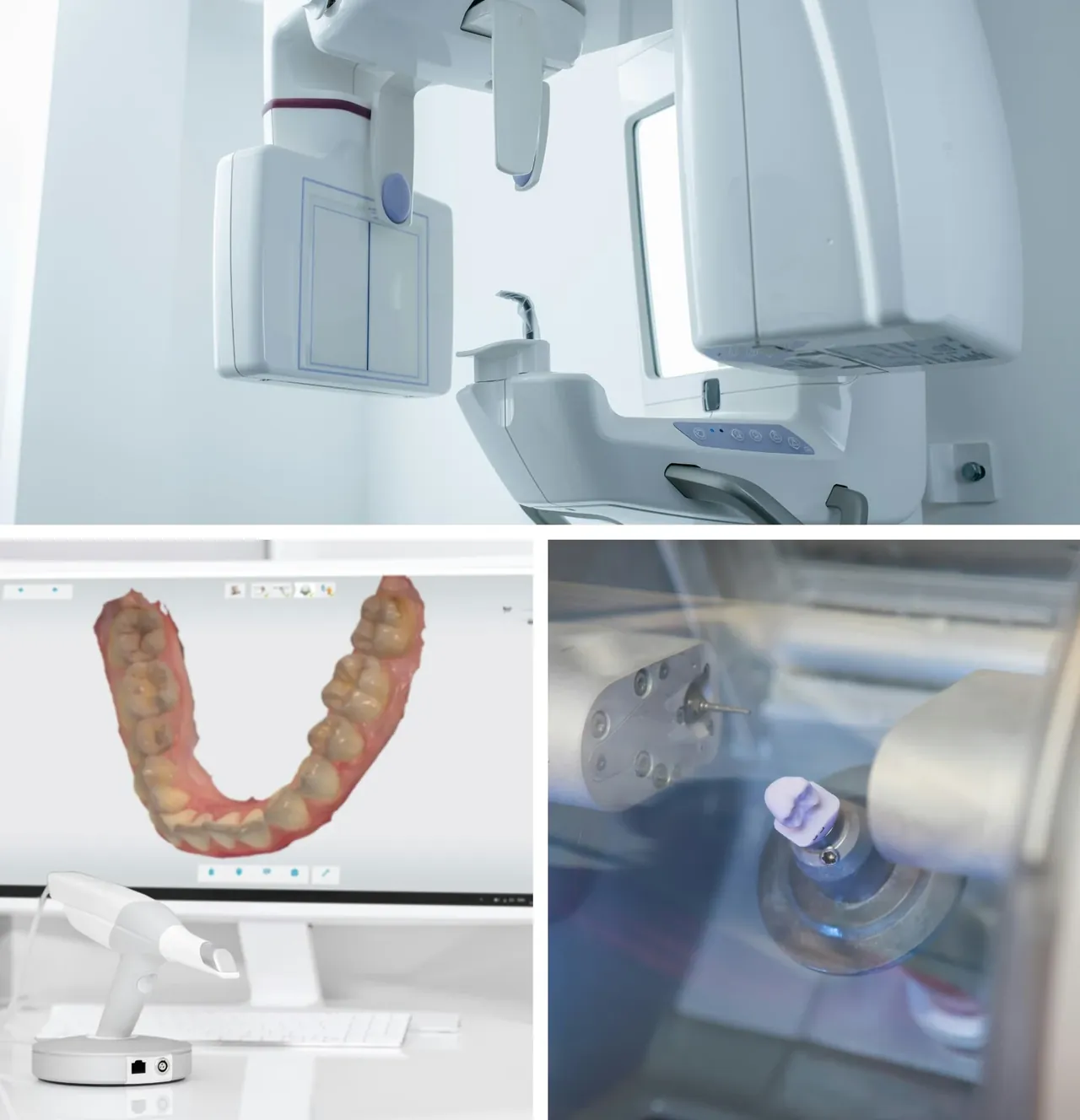 The scanner, the mill and the intraoral camera used at The Smile Center.